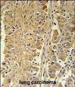 PGD Polyclonal Antibody
