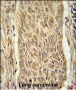 INMT Polyclonal Antibody
