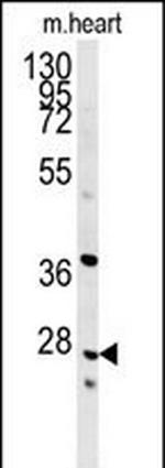 INMT Antibody in Western Blot (WB)