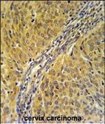 DYNC1LI2 Polyclonal Antibody
