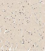 USP17 Antibody in Immunohistochemistry (Paraffin) (IHC (P))