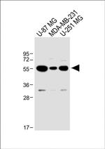 USP17 Antibody in Western Blot (WB)