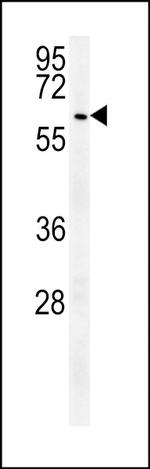 USP17 Antibody in Western Blot (WB)