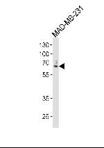 USP17 Antibody in Western Blot (WB)