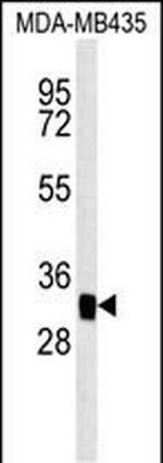 MTCH2 Antibody in Western Blot (WB)