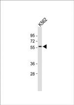MEIS2 Antibody in Western Blot (WB)