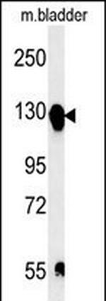 ITGA5 Polyclonal Antibody