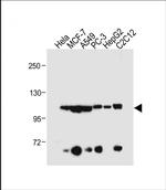 AHR Polyclonal Antibody