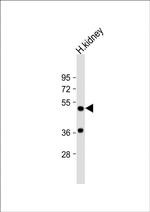 DOPA Decarboxylase Antibody in Western Blot (WB)