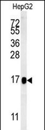 BLOC1S2 Antibody in Western Blot (WB)