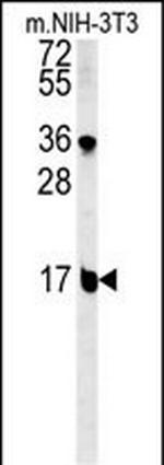 BLOC1S2 Antibody in Western Blot (WB)