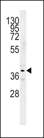 SRD5A2 Polyclonal Antibody