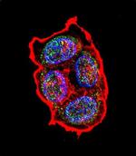 AVP Polyclonal Antibody