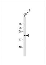AVP Antibody in Western Blot (WB)