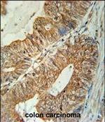 TSPAN3 Polyclonal Antibody