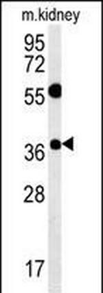 TSPAN3 Antibody in Western Blot (WB)
