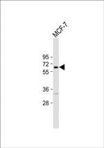 FBXO9 Polyclonal Antibody