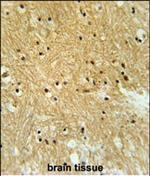 Importin 9 Polyclonal Antibody