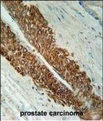STEAP2 Polyclonal Antibody