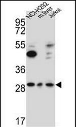 TAF1D Antibody in Western Blot (WB)