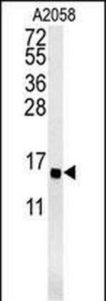 GOLT1A Polyclonal Antibody