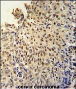 DIS3L Polyclonal Antibody