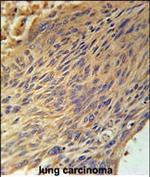 CPEB4 Polyclonal Antibody
