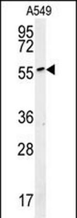 ALG10B Polyclonal Antibody
