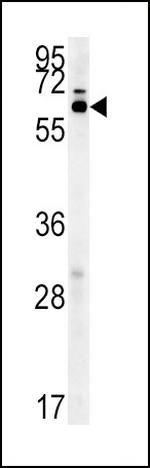 IKZF3 Polyclonal Antibody
