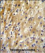 HABP2 Polyclonal Antibody
