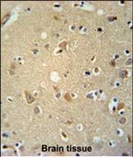 P2X7 Polyclonal Antibody