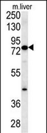 MCCC1 Polyclonal Antibody