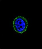 Calcitonin Receptor Polyclonal Antibody