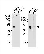 Calcitonin Receptor Antibody in Western Blot (WB)