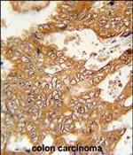 FBXO34 Polyclonal Antibody