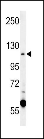 CACNA2D4 Polyclonal Antibody