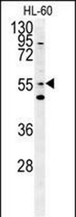LMAN1L Polyclonal Antibody