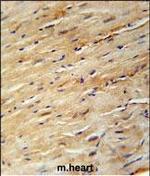 KIF24 Polyclonal Antibody
