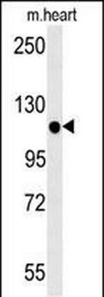 KIF24 Antibody in Western Blot (WB)