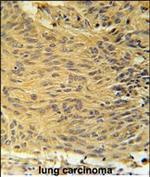 LCLAT1 Polyclonal Antibody