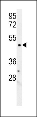 LCLAT1 Antibody in Western Blot (WB)