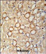 CRB2 Polyclonal Antibody
