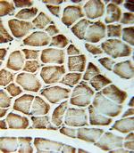 VLDLR Antibody in Immunohistochemistry (Paraffin) (IHC (P))