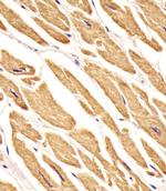 VLDLR Antibody in Immunohistochemistry (Paraffin) (IHC (P))