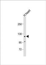 VLDLR Antibody in Western Blot (WB)