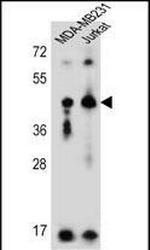 KIR2DL2 Polyclonal Antibody