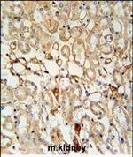 KCNV1 Polyclonal Antibody