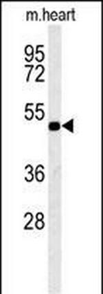 KCNV1 Antibody in Western Blot (WB)