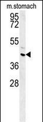 FAM26E Antibody in Western Blot (WB)