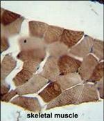 ST3GAL5 Polyclonal Antibody